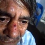ONG’S SE PRONUNCIAN CONTRA AGRESIÓN A LUCHADOR SOCIAL DE ZACATEPEC